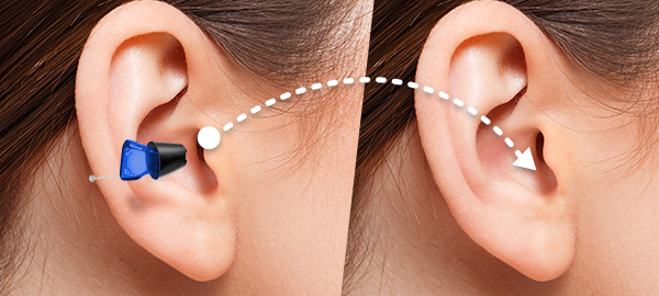 Invisible Hearing Aids in Faridabad